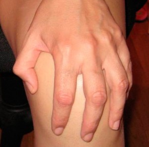 Dolor anterior de rodilla